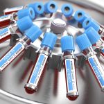 Coronavirus COVID-19 blood test samples tubes in centrifuge. Diagnostic medical laboratory.